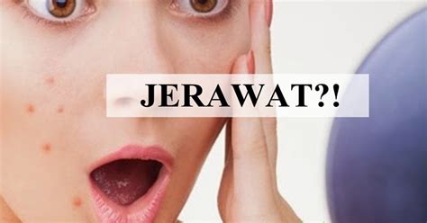 Kenapa Jerawat Tumbuh Lepas Makan Vitamin Rahsia Jelita Hawa Agen