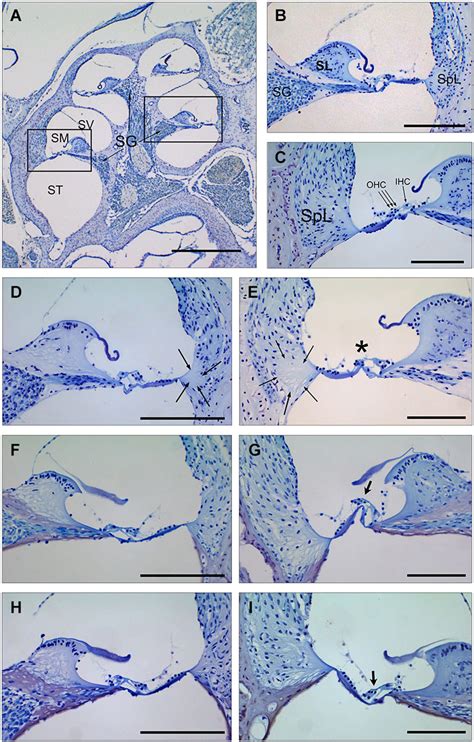 Cochlear Morphology In Mice Treated With Tgf β1 Inhibitors Before Being