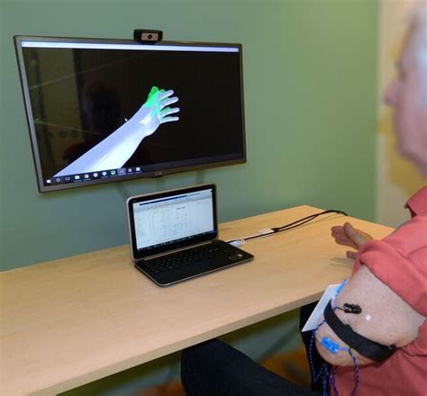 Can Vr Games Soothe Phantom Limb Pain Medpage Today