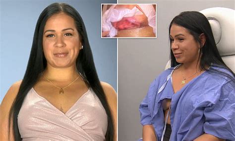 Woman Who Got A Boob Job In The Dominican Republic Reveals Her Implants Fell Out Daily Mail Online