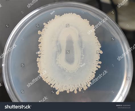 Candida Albicans Growing On Sabouraud Dextrose Stock Photo 1563059965