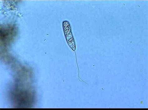 Lesson 6 Protozoa