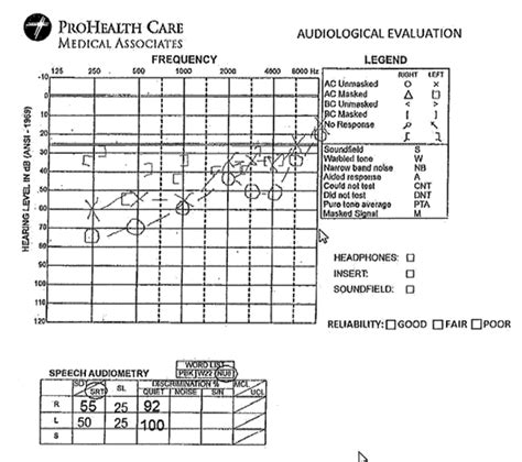 Hearing Aid Process And Guidance