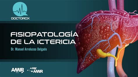 FisiopatologÍa Y Aspectos ClÍnicos De La Ictericia Doctor Cix Udocz