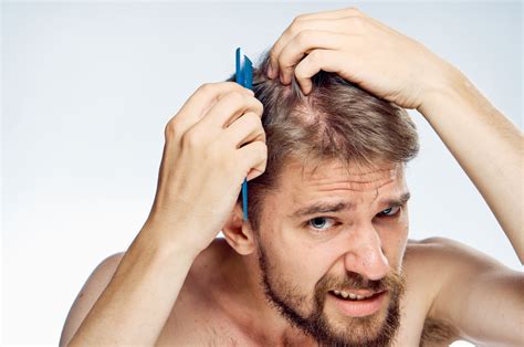 July and august and november through early january are common times for additional hair shedding. Can Low Testosterone Cause Hair Loss? - UltraCorePower