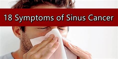 Sinus Cancer Symptoms 18 Signs Of Nasal Cavity Cancers