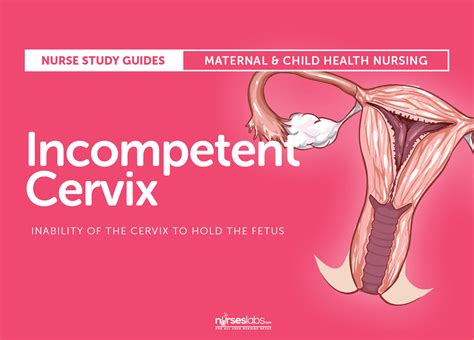 Incompetent Cervix Nursing Care Management