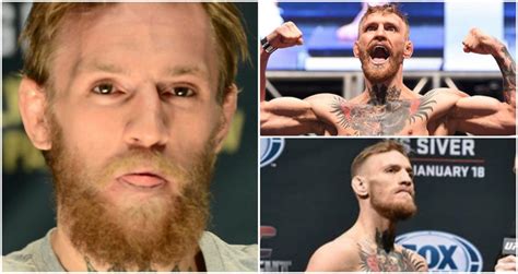 Conor Mcgregor Ufc Star At Featherweight Just Doesnt Look Healthy At All