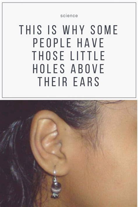 This Is Why Some People Have Those Little Holes Above Their Ears Wise
