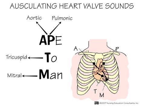 For more mnemonics, see the pastest book ʻmnemonics for medical undergraduatesʼ. Auscultating heart valve sounds...good little trick to ...