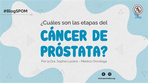 Conoce Cuales Son Las Causas Del Cancer De Prostata Las Etapas Y My Xxx Hot Girl