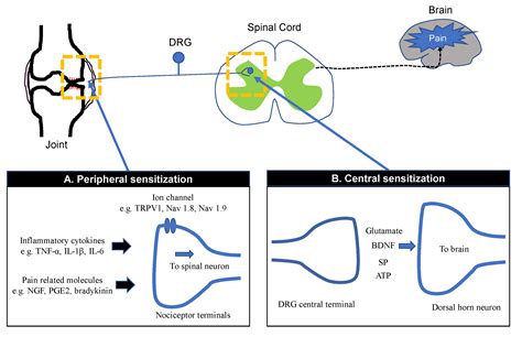 Cureus Mechanisms Of Peripheral And Central Sensitization In