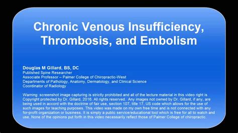 Chronic Venous Insufficiency Thrombosis Blood Clots And Embolism
