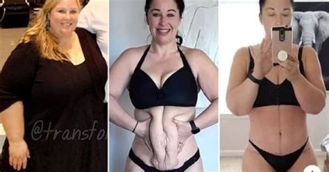A Woman Lost An Incredible 234 Lbs But Had To Undergo Surgery To Remove The Excess Skin Small