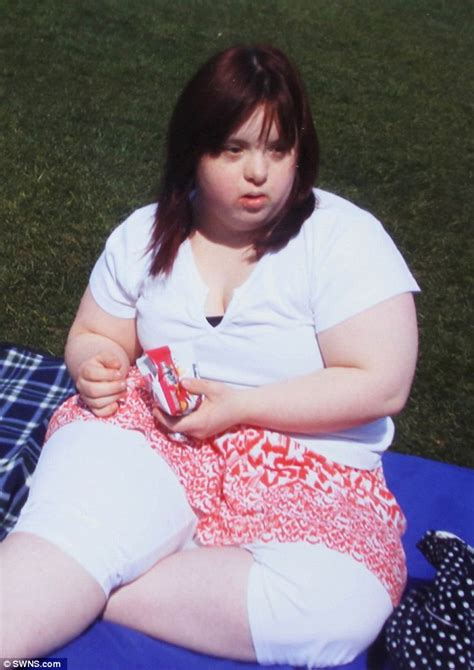 Woman With Down S Syndrome Loses Six Stone Daily Mail Online