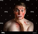 Young man with blood on his face hold himself for the neck Stock Photo ...