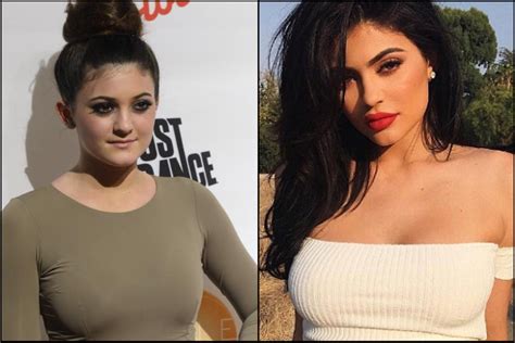 Kylie Jenner On Never Having Surgery On Her Face Photos