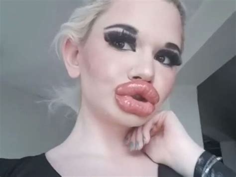 Lady With Biggest Lips In The World Lipstutorial Org