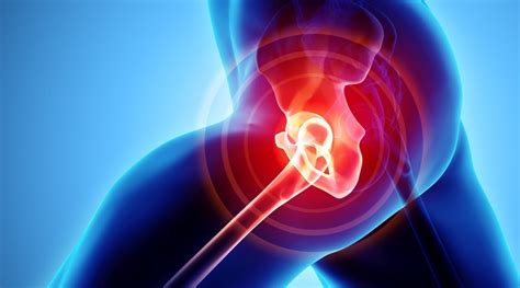 Benefits Of Cbd For Hip Bursitis Hemp Life Mag