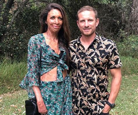 Turia Pitt And Michael Hoskin Love Story In Pictures