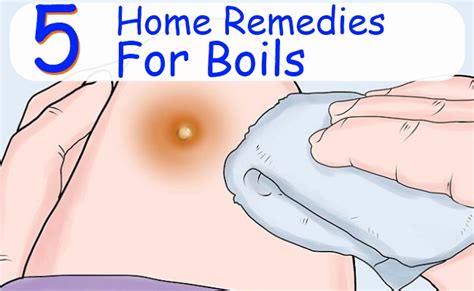 5 Best Home Remedies For Boils Morpheme Remedies India