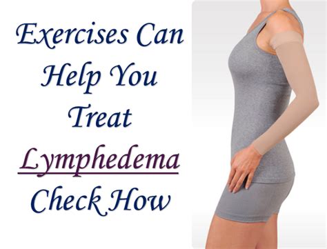 Exercises Can Help You Treat Lymphedema Lymphedema Lymphedema