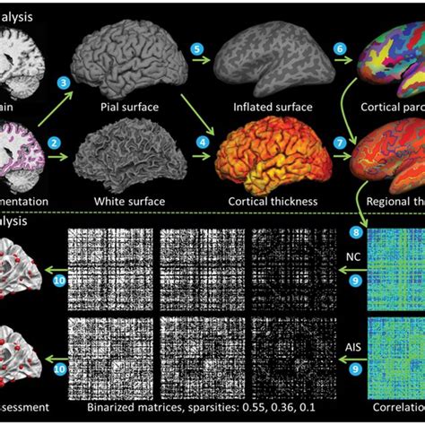 Whole Schematic Flowchart Of Cortical Structural Network Download