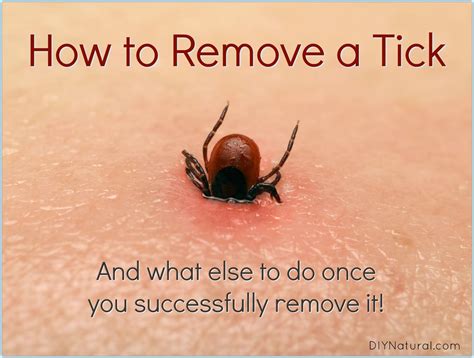 How To Remove A Tick Once You Have Been Bitten How To Remove A Tick