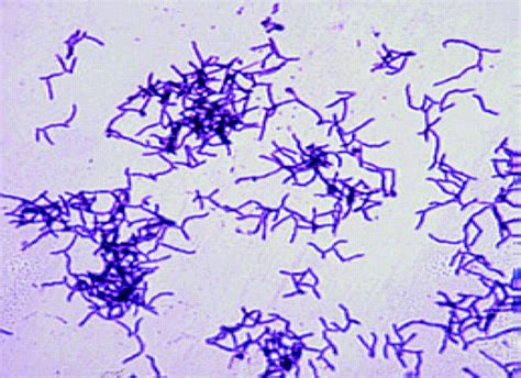Actinomycetes Gram Positive Bacilli Antler Like Branching