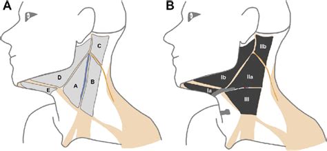 Graphic Scheme Of A Systematic Supraomohyoid Neck Dissection Sohnd