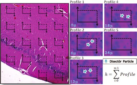 Neurons Counting By Using The Optical Dissector Unbiased Counting