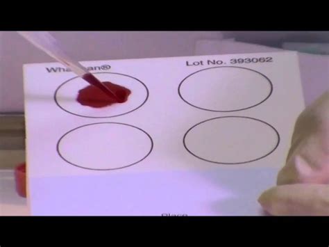 The no blood card that jehovah's witnesses carry with them has experienced very significant changes over the years, as you will see in this article. Making Dried Blood Spots on Whatman FTA Cards - YouTube