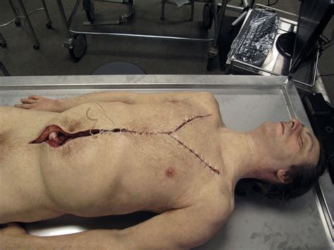 Autopsy Body Vincent Van Dyke Effects