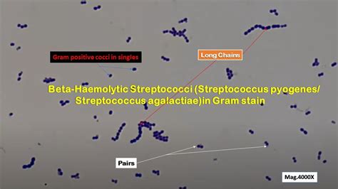 Gram Positive Cocci In Singles Pairs Chains Short And Long Of Beta Haemolytic Streptococci