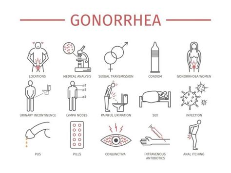 super gonorrhea history diagnosis last news pictures