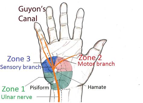 Guyons Canal Anatomy Pictures Hand Therapy Ulnar Nerve Carpal