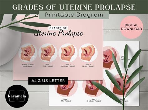 Buy Printable Diagram Of Uterine Prolapse Grading Stages Of Online In India Etsy