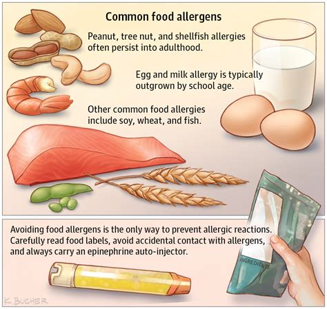 The 8 Most Common Food Allergies Include Food Ideas
