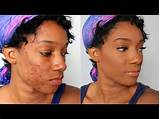 Makeup Foundation For Sensitive Skin Pictures