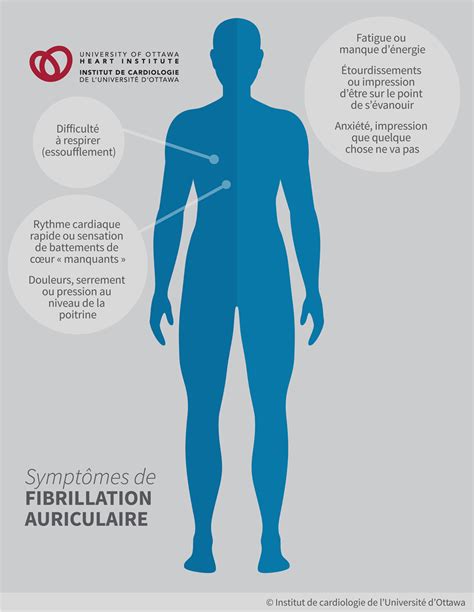 Fibrillation Auriculaire Institut De Cardiologie De Luniversité Dottawa