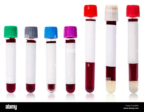 Collection Blood Tube Different Color And Size Of Blood Tube With