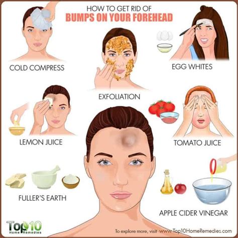 Bumps On Forehead 8 Home Remedies To Reduce It Forehead Bumps