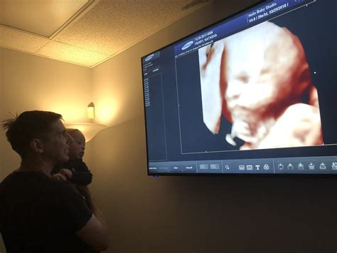 Become A Sonographer Ultrasound Technician Schools Fayetteville Nc