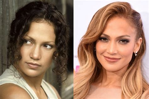 Jennifer Lopez Before And After Plastic Surgery