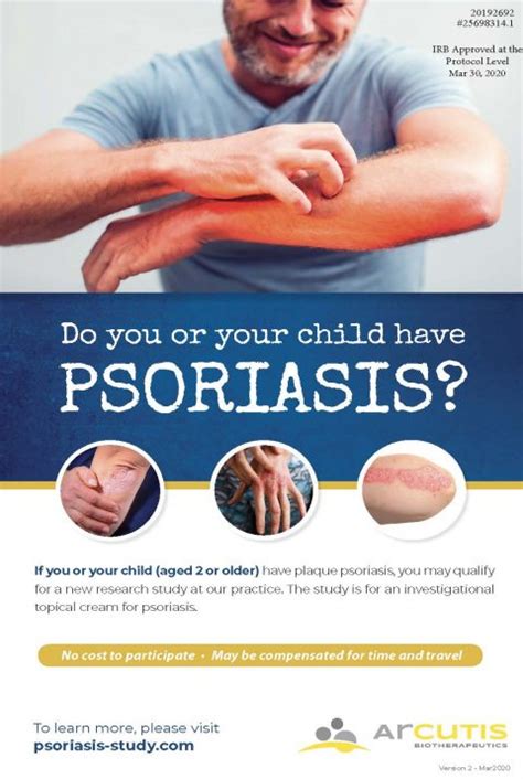 Psoriasis Clinical Trial Aesthetic And Dermatology Center