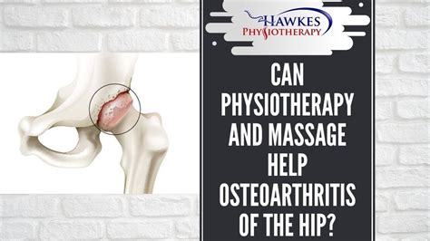 Can Physiotherapy And Massage Help Osteoarthritis Of The Hip Youtube