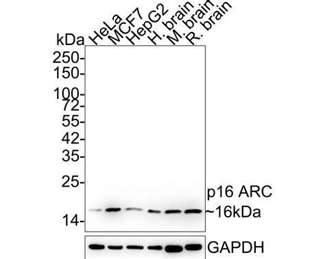 P16 Arc Recombinant Rabbit Monoclonal Antibody Sr34 02 Et1602 9