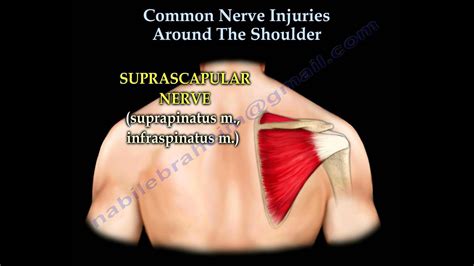 Shoulder Nerve Injury Injuries Everything You Need To Know Dr