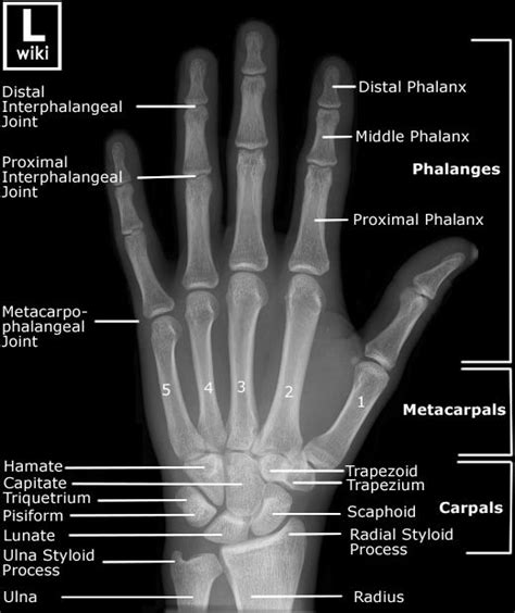 Hand Radiographic Anatomy Wikiradiography Radiology Radiology