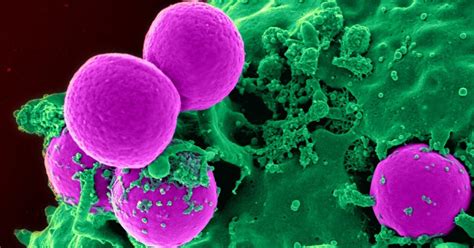 Los 3 Tipos De Bacterias Características Y Morfología